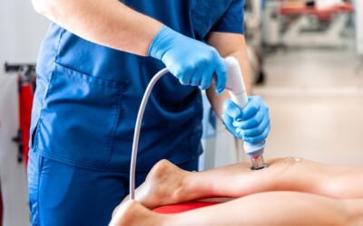 Cold Laser Therapy for Peripheral Neuropathy: A Revolutionary Treatment